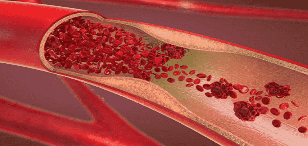 مراحل تكوين كريات الدم الحمراء