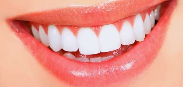 التهاب اللثة مع تلبيس الأسنان
