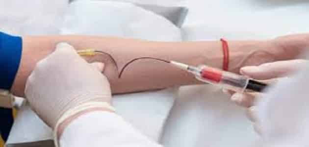 تحليل ترسبات الدم الطبيعي
