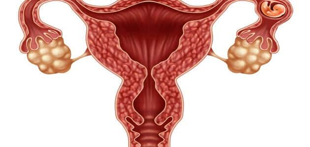 ما هي أعراض الحمل خارج الرحم