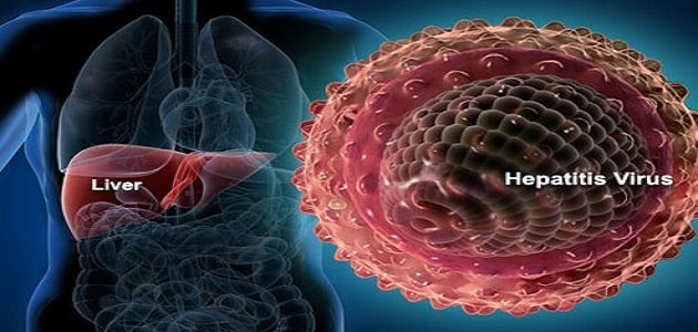 أعراض التهاب الكبد الفيروسي