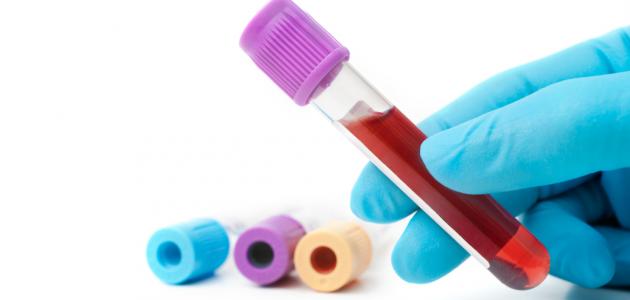نسبة الدي دايمر d-dimer الطبيعية