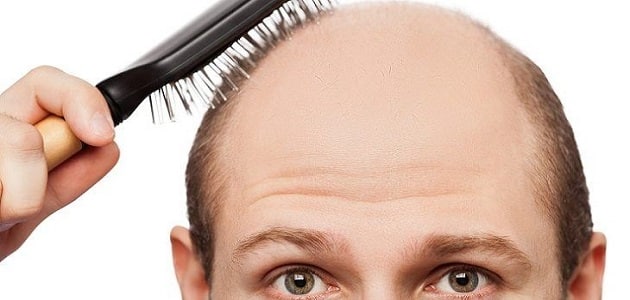 علاج صلع الشعر من الجانبين