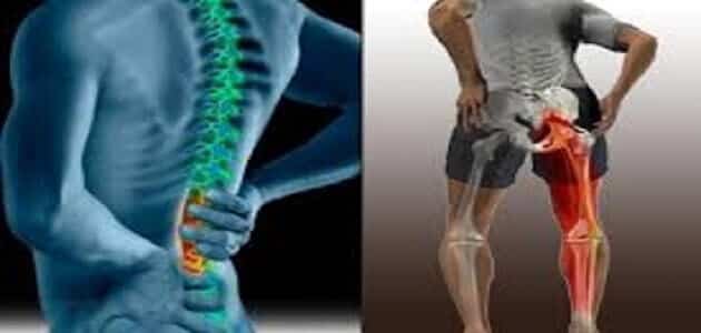 طريقة جلوس مريض عرق النسا