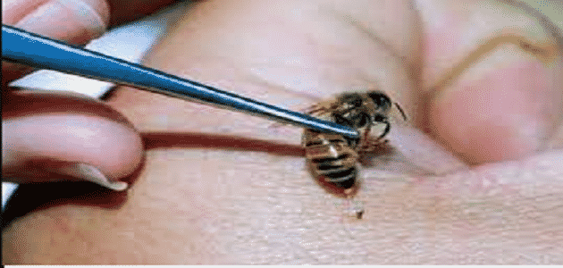 فوائد قرص النحل للعضو الذكري