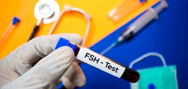 تحليل fsh النسبة الطبيعية - مقال
