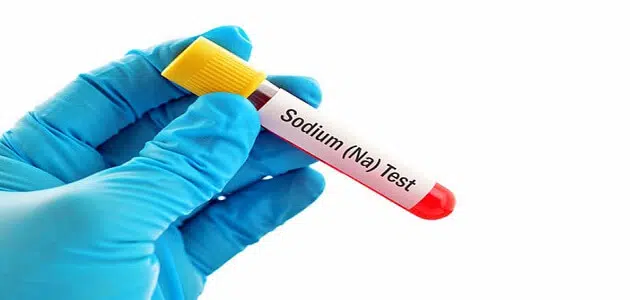 ما هي أعراض نقص الصوديوم في جسم الإنسان